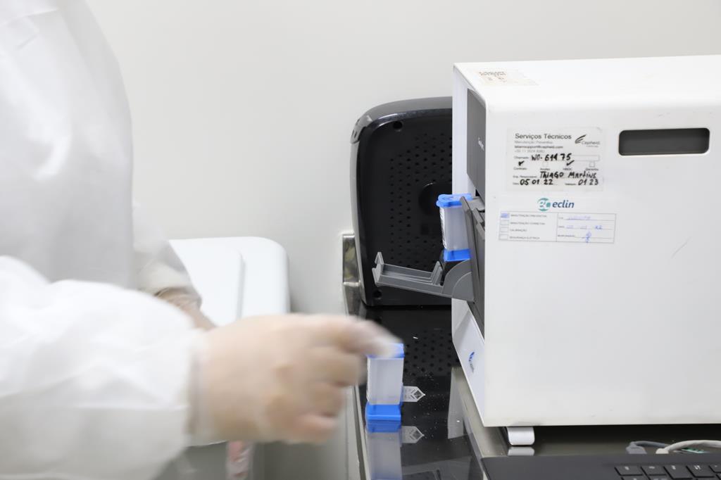 Saúde promove nova busca ativa para detectar casos de tuberculose na cidade