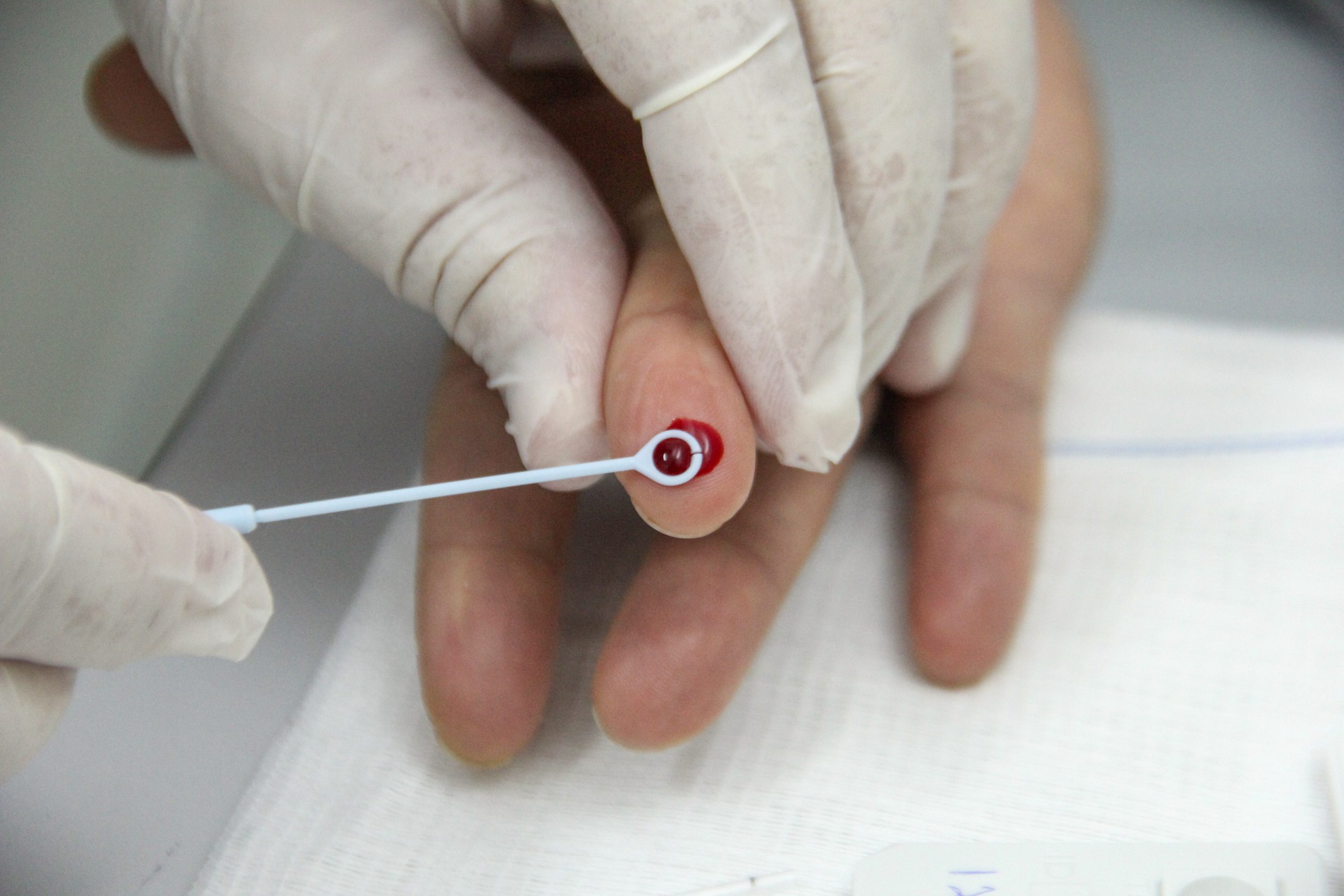 <strong>Dezembro Vermelho começa com ações&nbsp;</strong><strong>de conscientização e testes rápidos</strong>